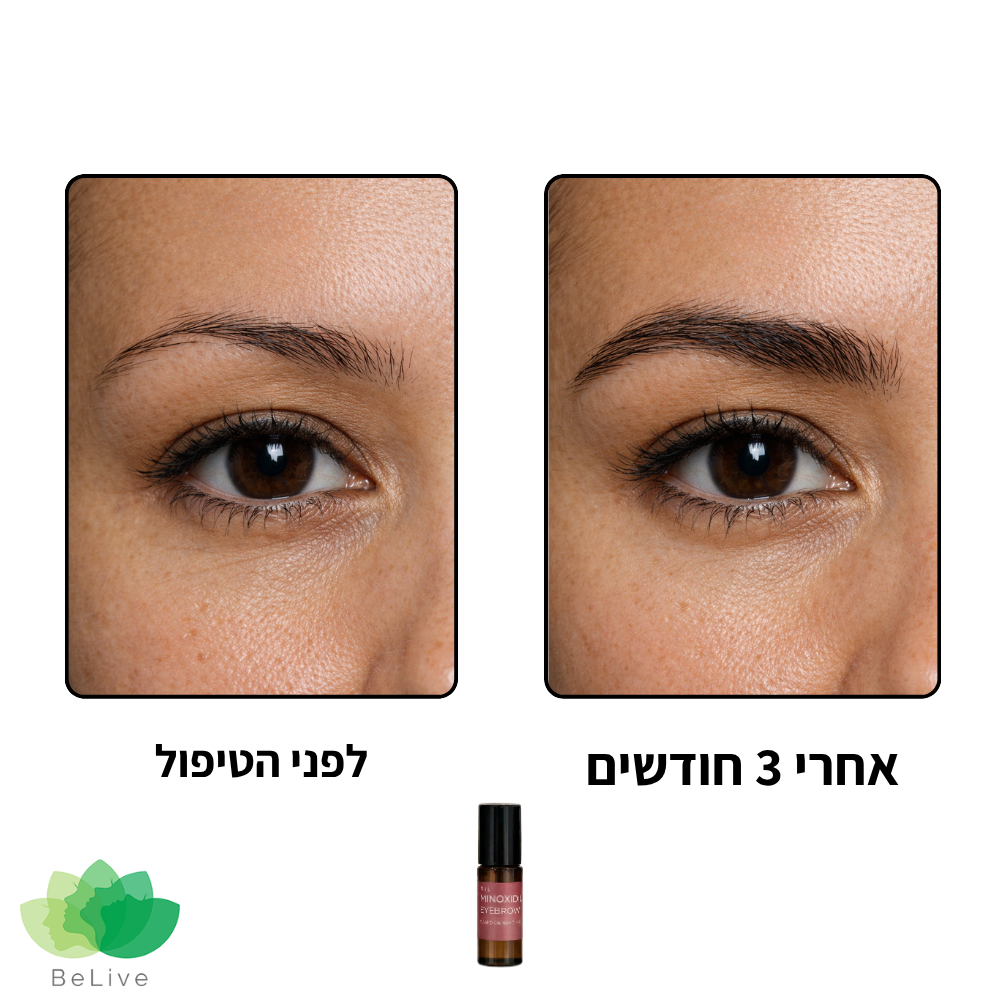 פורמולה רפואית NANOMiii לשיקום ועיבוי הגבות (רולר)