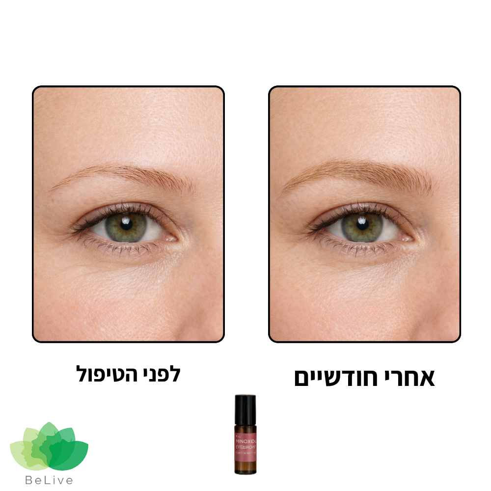 פורמולה רפואית NANOMiii לשיקום ועיבוי הגבות (רולר)