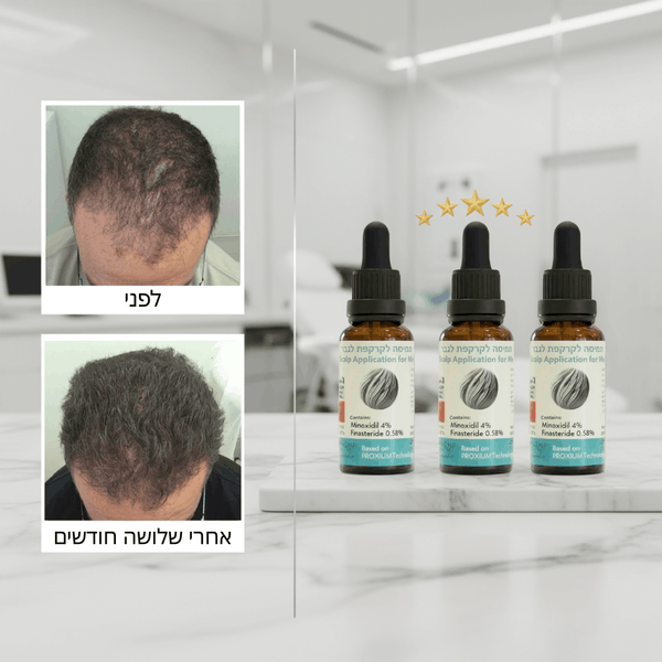 פורמולה רפואית PROXIUM לשיקום ועיבוי השיער לגבר