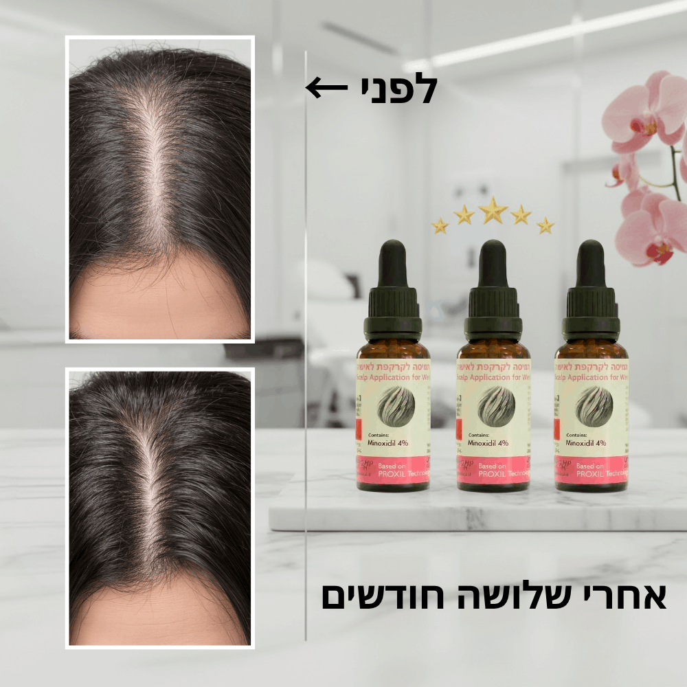 פורמולה רפואית PROXIL לשיקום ועיבוי השיער לאישה
