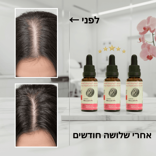 פורמולה רפואית PROXIL לשיקום ועיבוי השיער לאישה
