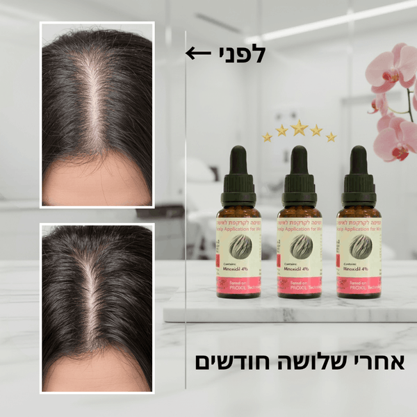 פורמולה רפואית PROXIL לשיקום ועיבוי השיער לאישה
