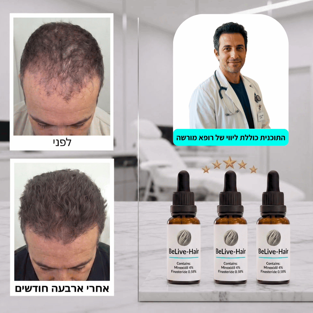 תוכנית PROXIUM — טיפול וליווי רפואי לשיקום השיער