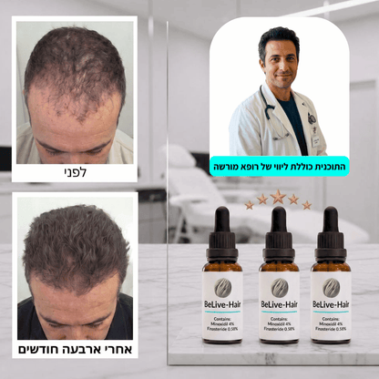 תוכנית PROXIUM — טיפול וליווי רפואי לשיקום השיער