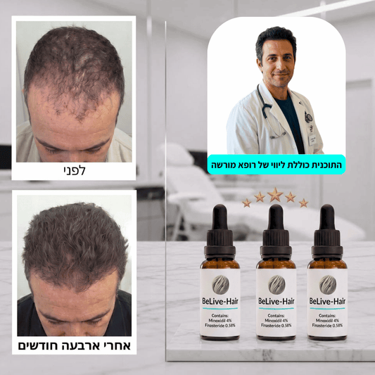 תוכנית PROXIUM — טיפול וליווי רפואי לשיקום השיער