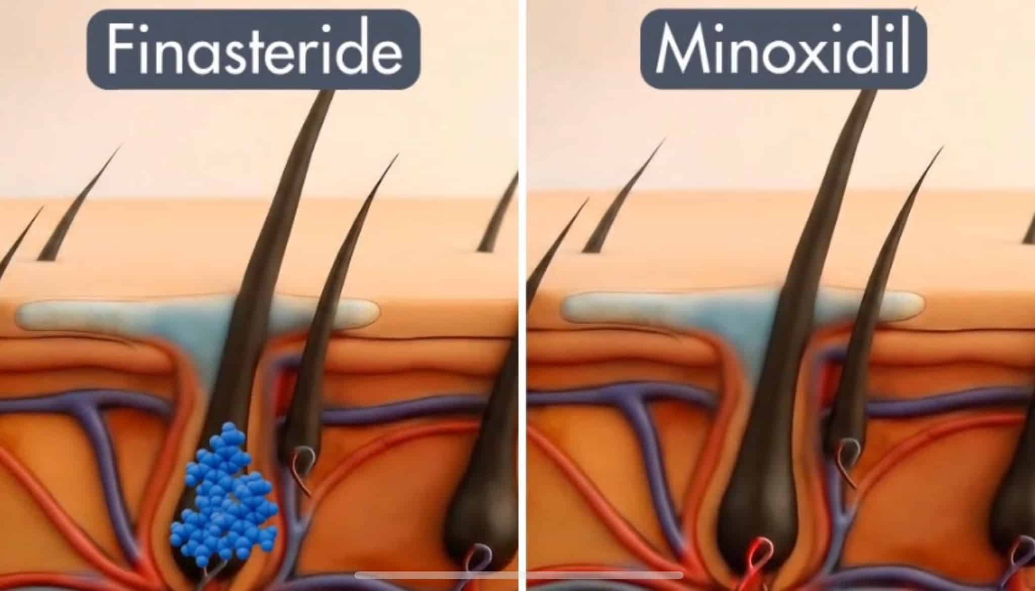 וידאו נטען: 